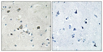 Ribosomal Protein S4Y1 antibody