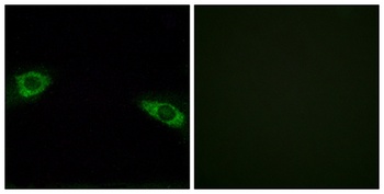 Ribosomal Protein S4Y1 rabbit pAb
