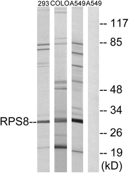 Ribosomal Protein S8 antibody
