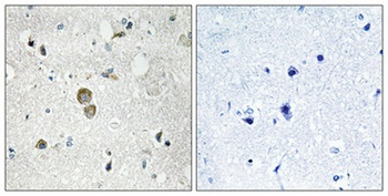 Ribosomal Protein S9 rabbit pAb