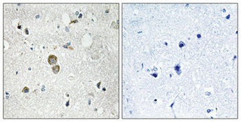 Ribosomal Protein S9 antibody