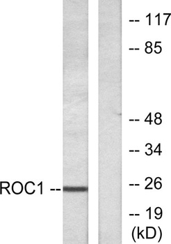 Rit1 antibody