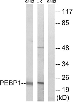 RKIP rabbit pAb