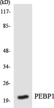 RKIP antibody