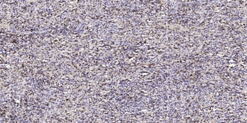 RKIP antibody