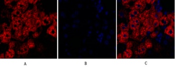 Rock-1 antibody