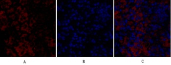 Rock-1 antibody