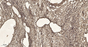 Rock-2 rabbit pAb