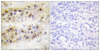 RORα rabbit pAb