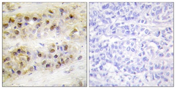 ROR alpha antibody