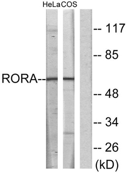 RORα rabbit pAb
