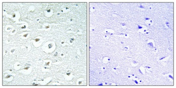 RoXaN rabbit pAb
