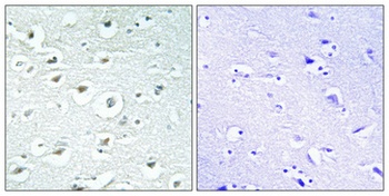 RoXaN antibody