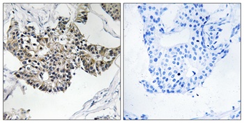 RSAD1 rabbit pAb Antibody