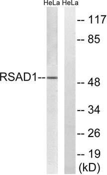 RSAD1 rabbit pAb Antibody
