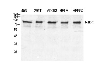 Rsk-4 rabbit pAb Antibody