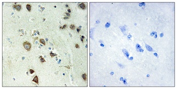 Rsk-4 rabbit pAb Antibody