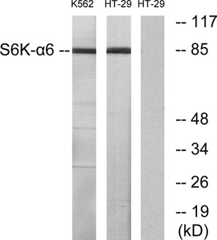 Rsk-4 rabbit pAb Antibody