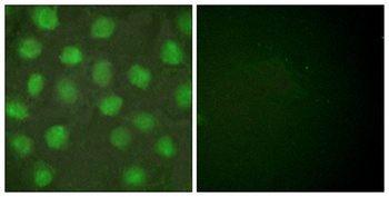 RXR gamma antibody