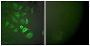 S-100 α rabbit pAb