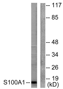 S-100 alpha antibody