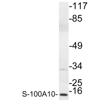 S-100A10 antibody