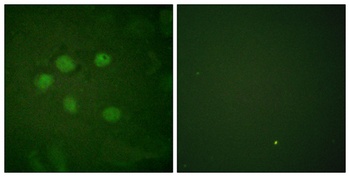 SAE1 antibody