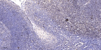 SAE1 antibody