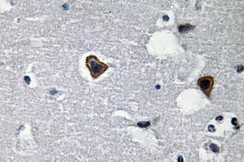 Sarcoglycan-β rabbit pAb