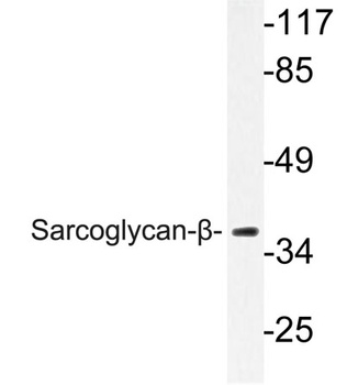Sarcoglycan-β rabbit pAb