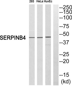 SCCA2 rabbit pAb