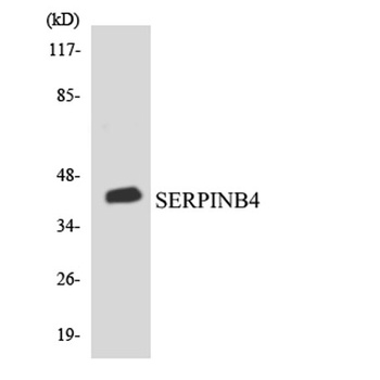 SCCA2 rabbit pAb