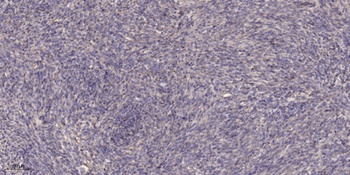 SCCA2 antibody