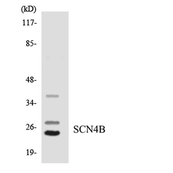 Scn4b antibody
