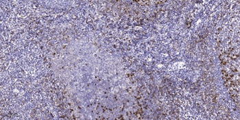 Scn4b antibody