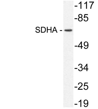 SDHA rabbit pAb