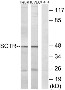 Secretin Receptor rabbit pAb