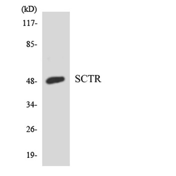 Secretin Receptor rabbit pAb