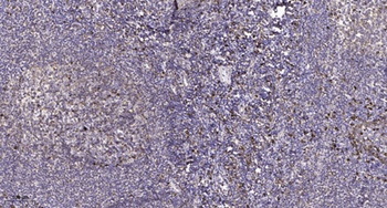 Secretin Receptor rabbit pAb