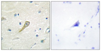 SEMA4A antibody