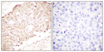 SENP1 antibody