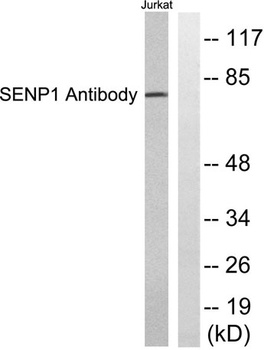 SENP1 antibody