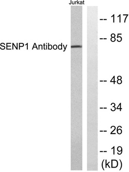 SENP1 rabbit pAb