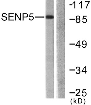 SENP5 rabbit pAb