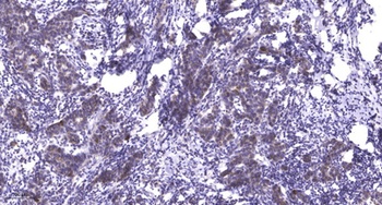 SERCA1 antibody