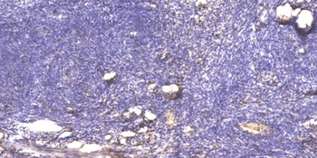 Serpin B12 antibody