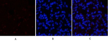 SGK1 antibody