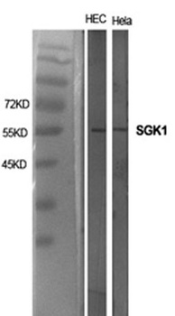 SGK1 antibody