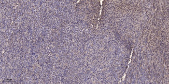 SH-PTP1 antibody