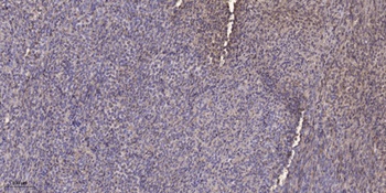 SH-PTP1 rabbit pAb